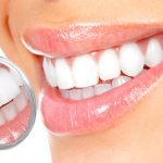 clareamento dental