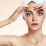 acne adulta - como tratar